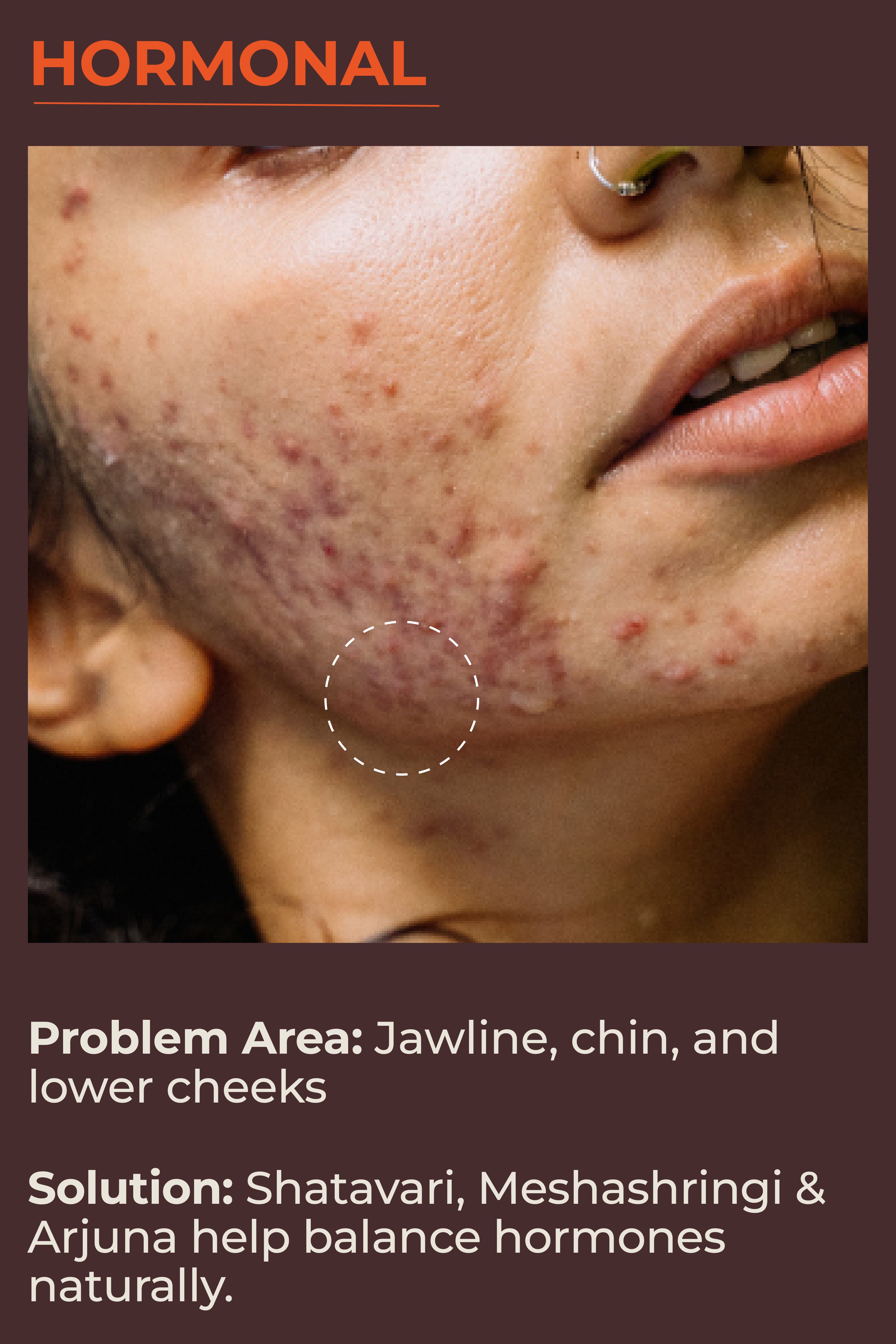 Mobile Slide Image